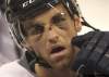 Winnipeg Free Press archives
Andrew Ladd  was hit in the face with a puck during a recent game against the Ottawa Senators.