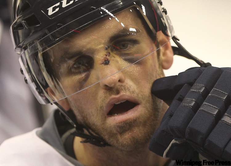 Winnipeg Free Press archives
Andrew Ladd was hit in the face with a puck during a recent game against the Ottawa Senators.