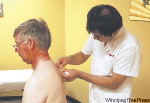 KEN.GIGLIOTTI@freepress.com
Zhaocheng Han, above right, treats Lucien Guillas for asthma with tiny acupuncture needles, below.