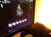 TREVOR HAGAN / WINNIPEG FREE PRESS
Echocardiogram machine at Prota Clinic, Wednesday, December 27, 2017.