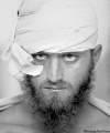 CP
Pakistani Hamza Aapel, 23, was injured in the Taliban's twin suicide attacks.