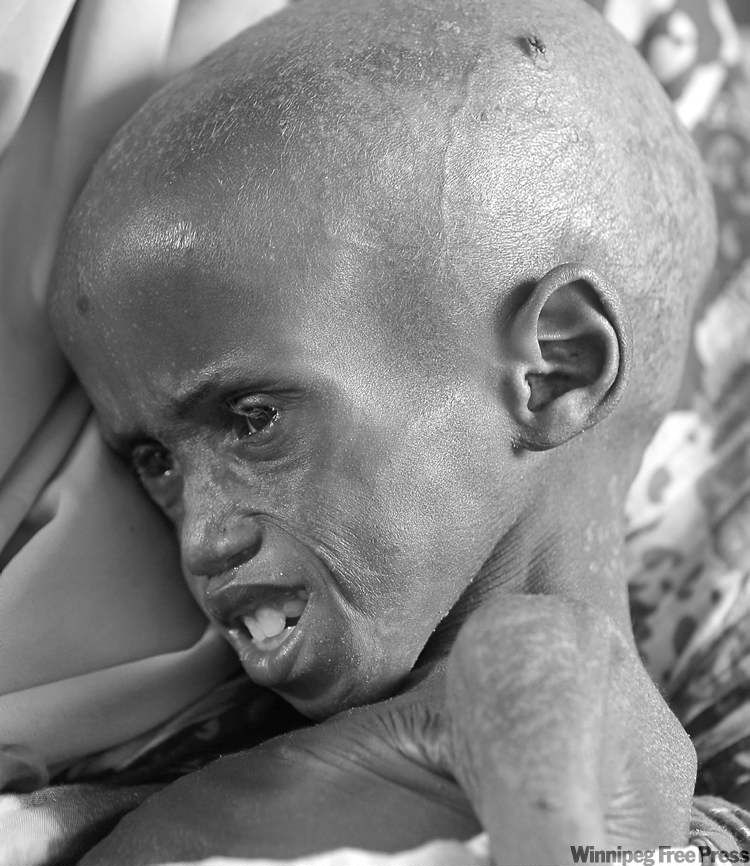CP
schalk van zuydam / the associated press
A child awaits treatment at a Doctors Without Borders field hospital in Dadaab, Kenya, Monday.