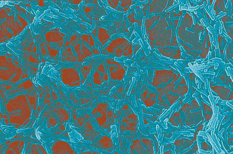 Gut-busting bacteria – Winnipeg Free Press