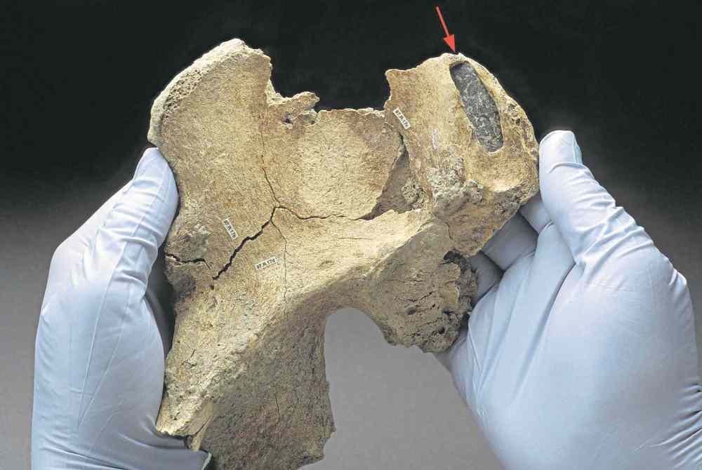 Bloomberg The Washington Post
Chip Clark / Smithsonian Institute
Researchers concluded a stone spear point found embedded in Kennewick Man�s right hip suggests he belonged to an ancient population and that he suffered the wound during a violent confrontation.