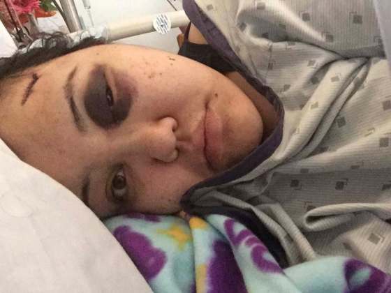 SUPPLIED PHOTOA third teen has been charged in a brutal attack against Jackie Healey, 23, (pictured) and a support worker at the Behavioural Health Foundation male youth facility in Selkirk.