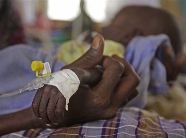 The arm of Mihag Gedi Farah, a seven-month-old child with a weight of 3.4kg, is held by his motherl in a field hospital of the International Rescue Committee, IRC, in the town of Dadaab, Kenya, Tuesday, July 26, 2011. The U.N. will airlift emergency rations this week to parts of drought-ravaged Somalia that militants banned it from more than two years ago, in a crisis intervention to keep hungry refugees from dying along what an official calls the