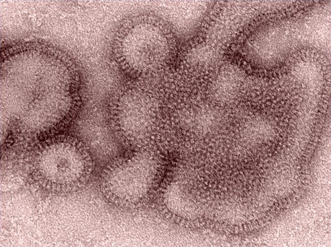 This scanning electron micrograph view depicts some of the ultrastructural details displayed by H3N2 influenza virions responsible for casing illness in Indiana and Pennsylvania in 2011. THE CANADIAN PRESS/ho-Centers for Disease Control and Prevention