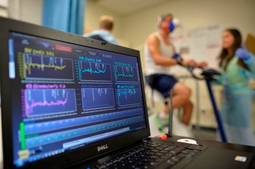 FILE - In this Aug. 27, 2014 file photo, a laptop computer monitors a patient's heart function as he takes a stress test while riding a stationary bike in Augusta, Ga. A report released on Wednesday, Jan. 30 2019 estimates that nearly half of all U.S. adults have some form of heart or blood vessel disease, a medical milestone that's mostly due to recent guidelines that expanded how many people have high blood pressure. (AP Photo/The Augusta Chronicle, Michael Holahan)