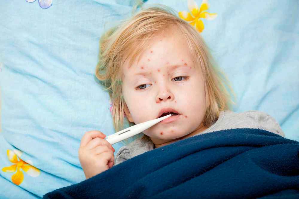 Although virtually eradicated by the year 2000 through the use of vaccinations, measles has made a comeback because of the anti-vax movement: more than 110,000 people, mostly young children, died from measles in 2017. (Dreamstime files)
