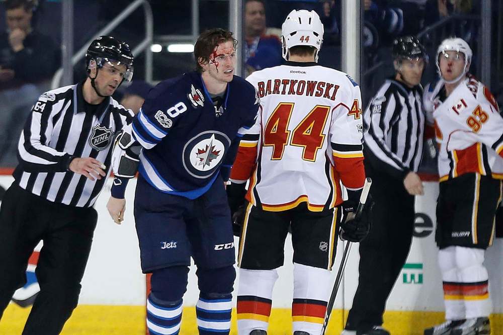 John Woods / THE CANADIAN PRESS
Winnipeg Jets Jacob Trouba bleeds from a cut he suffered in a fight with Calgary Flames Sam Bennett at the MTS Centre Saturday.