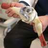 M. Spencer Green / The Associated Press Files
Health-care consumers need more information about followup therapy after knee and hip replacements.