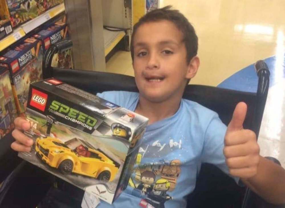 Kyle Aftimos, 9, after surgery last year. MUST CREDIT: Family photo.