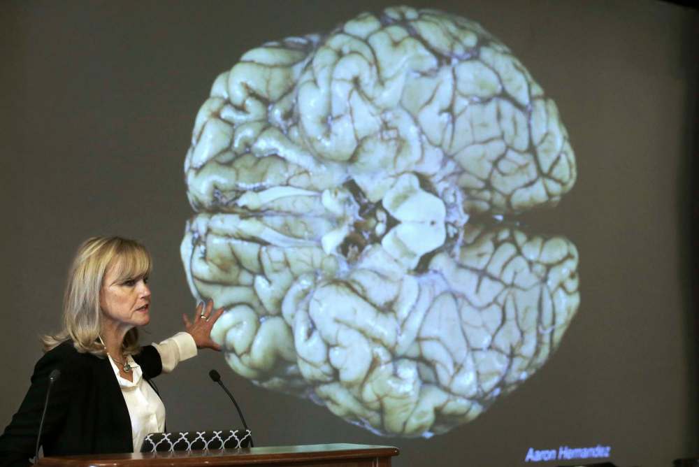 A study by researchers at Boston University found evidence of CTE in the brains of 110 of 111 deceased former NFLers they studied. Above, Ann McKee of Boston University's center for research into the degenerative brain disease chronic traumatic encephalopathy, talks about the damage to former NFL football player Aaron Hernandez's brain, projected on a screen behind her. (Steven Senne / The Associated Press Files)