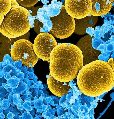 National Institute of Allergy and Infectious Diseases
The Staphylococcus aureus bacteris is justone of billions of microbes in the world.