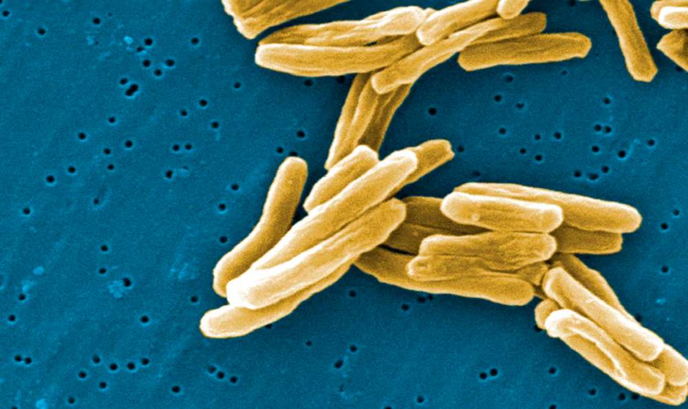 THE CANADIAN PRESS/HO, CDC
The Mycobacterium tuberculosis (TB) bacteria is shown in a high magnification scanning electron micrograph image.