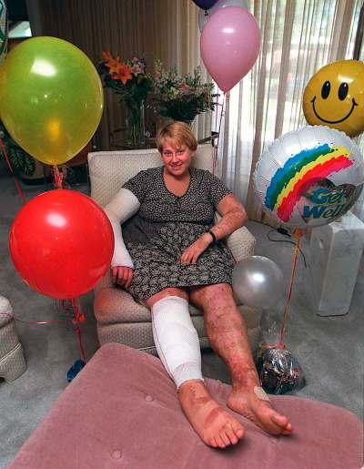 Ken Gigliotti / Winnipeg Free Press Files
Sherri Wise at home in 1997 recuperating from a terrorist attack in Israel.