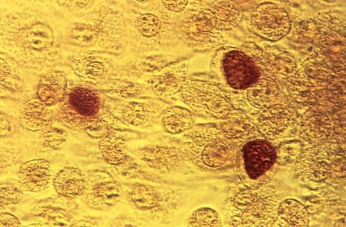 FILE - This 1975 file microscope image made available by the the Centers for Disease Control and Prevention shows chlamydia trachomatis bacteria magnified 200 times. U.S. infections from three sexually-transmitted diseases have risen for the fifth consecutive year and broken more records. More than 1.7 million cases of chlamydia were reported in 2018. (Dr. E. Arum, Dr. N. Jacobs/CDC via AP, File)