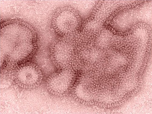 FILE - This 2011 electron microscope image provided by the Centers for Disease Control and Prevention shows H3N2 influenza virions. In January 2019, the flu season was shaping up to be one of the shortest and mildest in recent U.S. history. But a surprising second viral wave has just made it the longest, according to the flu statistics released on Friday, April 19, 2019. (Dr. Michael Shaw, Doug Jordan/Centers for Disease Control and Prevention via AP)