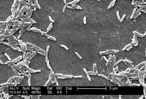 This 2004 electron microscope image made available by the Centers for Disease Control and Prevention shows Gram-negative Campylobacter fetus bacteria. As of April 2019, recent illnesses tied to raw turkey, ground beef, cut melon and romaine lettuce suggest, U.S. food poisoning cases don‚Äôt appear to be going away anytime soon. Salmonella and campylobacter are allowed in raw poultry sold in supermarkets, noted Tony Corbo of Food and Water Watch, an advocacy group that supports stricter food safety regulations. It‚Äôs why health experts advise people to properly handle and cook poultry. (Janice Haney Carr/CDC via AP)