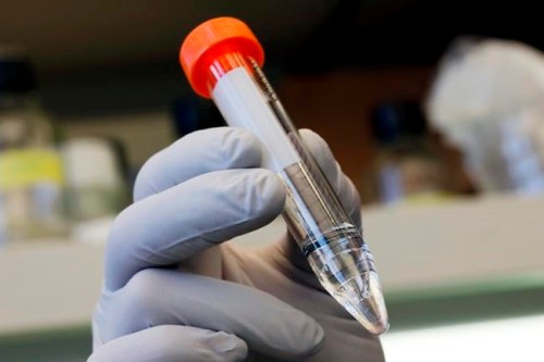 Yale University researcher Benjamin Chan, who studies viruses that attack bacteria, holds bacteriophage treatment for patient Ella Balasa, of Richmond, Va., at Osborn Memorial Laboratories, in New Haven, Conn., Thursday Jan. 17, 2019. Bacteriophages were discovered a century ago but largely shelved when easier-to-use antibiotics came along. (AP Photo/Richard Drew)