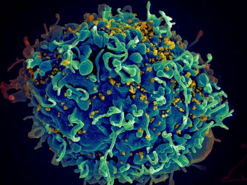 This electron microscope image made available by the U.S. National Institutes of Health shows a human T cell, in blue, under attack by HIV, in yellow, the virus that causes AIDS. The virus specifically targets T cells, which play a critical role in the body's immune response against invaders like bacteria and viruses. Colors were added by the source. On Thursday, March 6, 2019, researchers reported that monthly shots of HIV drugs worked as well as daily pills to control the virus that causes AIDS in two large international tests. (Seth Pincus, Elizabeth Fischer, Austin Athman/National Institute of Allergy and Infectious Diseases/NIH via AP)