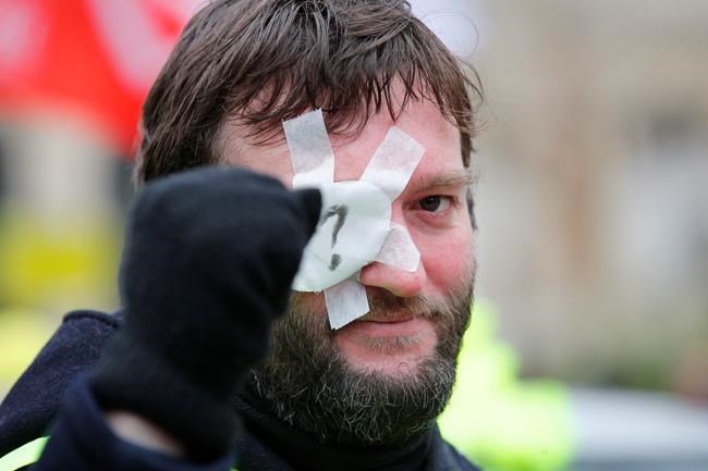 A protester attends the yellow vests demonstration Saturday, Feb. 2, 2019 in Paris. France's yellow vest protesters are taking to the streets to keep pressure on French President Emmanuel Macron's government and denounce the high number of people injured in demonstrations that they consider as the result of police violence.(AP Photo/Francois Mori)