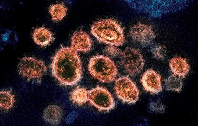 This 2020 electron microscope image provided by the National Institute of Allergy and Infectious Diseases - Rocky Mountain Laboratories shows SARS-CoV-2 virus particles which cause COVID-19, isolated from a patient in the U.S., emerging from the surface of cells cultured in a lab. nbsp; (NIAID-RML via AP)