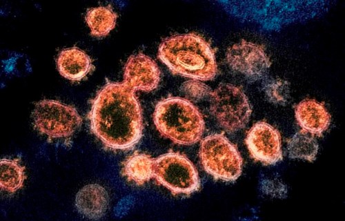 This 2020 electron microscope image provided by the National Institute of Allergy and Infectious Diseases - Rocky Mountain Laboratories shows SARS-CoV-2 virus particles which cause COVID-19, isolated from a patient in the U.S., emerging from the surface of cells cultured in a lab. nbsp; (NIAID-RML via AP)