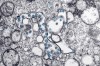 This 2020 electron microscope image made available by the U.S. Centers for Disease Control and Prevention shows the spherical particles of the new coronavirus, colorized blue, from the first U.S. case of COVID-19. Nova Scotia's COVID-19 numbers continue to climb with the province reporting 96 new cases today. THE CANADIAN PRESS/Hannah A. Bullock, Azaibi Tamin/CDC via AP