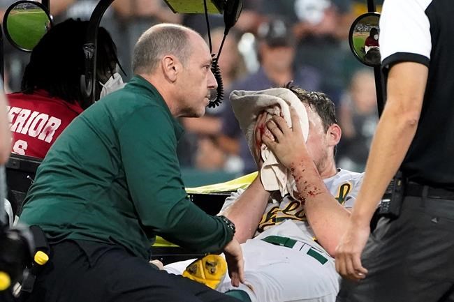 Oakland Athletics starting pitcher Chris Bassitt is taken off the field after getting hit in the head from a ball hit by Chicago White Sox's Brian Goodwin during the second inning of a baseball game, Tuesday, Aug. 17, 2021, in Chicago. (AP Photo/Charles Rex Arbogast)