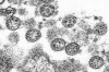 This 2020 electron microscope image made available by the U.S. Centers for Disease Control and Prevention shows the spherical coronavirus particles from what was believed to be the first U.S. case of COVID-19. THE CANADIAN PRESS/AP-C.S. Goldsmith, A. Tamin/CDC via AP