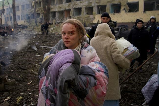 FILE - Mariana Vishegirskaya stands outside a maternity hospital that was damaged by shelling in Mariupol, Ukraine, Wednesday, March 9, 2022. Visheirskaya was taken to another nearby hospital where she gave birth the following day to a baby girl she named Veronika. “We were lying in wards when glass, frames, windows and walls flew apart,” she told AP, lying next to her newborn.