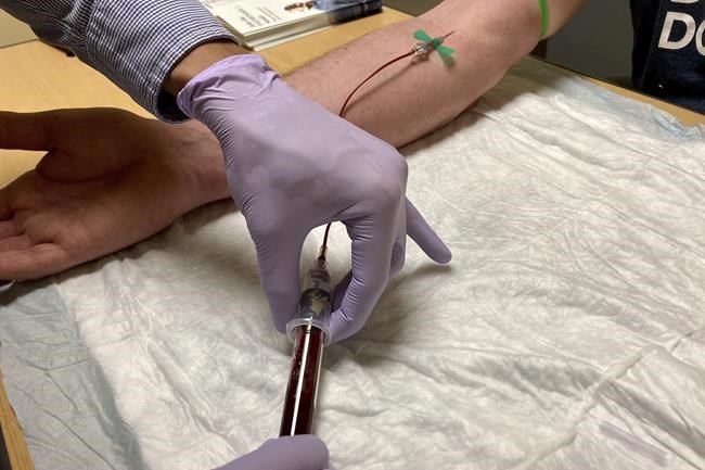 Jacob Marquez, a clinical research coordinator at Oregon Health & Science University's Knight Cancer Institute in Portland, Ore., draws blood from a clinical study participant on March 14, 2022. Parker is one of hundreds of people participating in a trial for a new liquid biopsy technology that could detect early signs of cancer in a person's blood. (AP Photo/Gillian Flaccus)