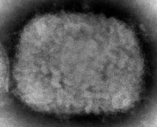This 2003 electron microscope image made available by the Centers for Disease Control and Prevention shows a monkeypox virion, obtained from a sample associated with the 2003 prairie dog outbreak. On Wednesday, May 18, 2022, Massachusetts has reported a rare case of monkeypox in a man who recently had traveled to Canada, and investigators are looking into whether it is connected to recent cases in Europe. (Cynthia S. Goldsmith, Russell Regner/CDC via AP)