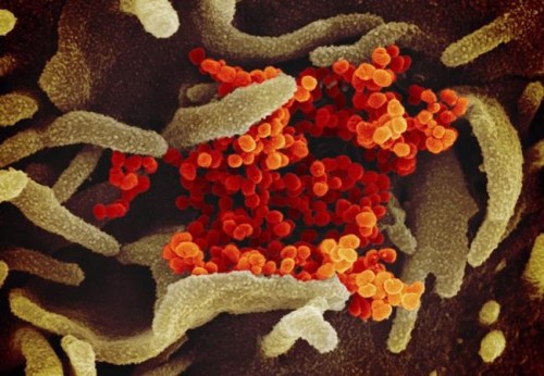 This undated electron microscope image made available by the U.S. National Institutes of Health in February 2020 shows the Novel Coronavirus SARS-CoV-2, orange, emerging from the surface of cells, green, cultured in the lab. Also known as 2019-nCoV, the virus causes COVID-19. The sample was isolated from a patient in the U.S. THE CANADIAN PRESS/AP-NIAID-RML via AP