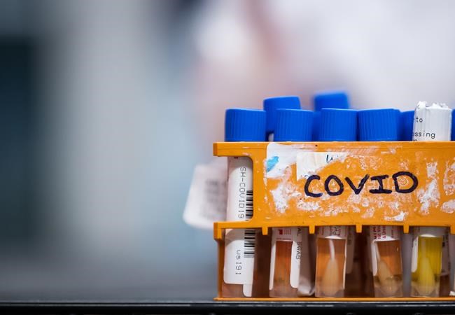 Specimens to be tested for COVID-19 are seen at LifeLabs after being logged upon receipt at the company's lab, in Surrey, B.C., on Thursday, March 26, 2020. Saskatchewan is reporting 60 new cases of COVID-19 mostly from Hutterites colonies in the south. THE CANADIAN PRESS/Darryl Dyck