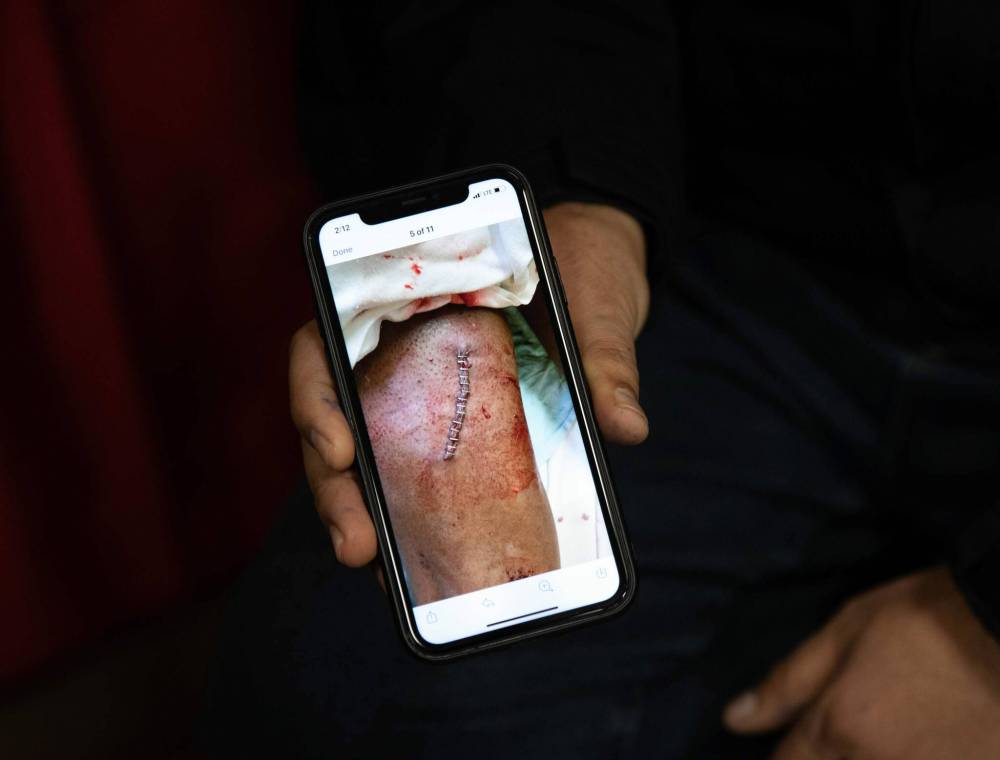 JESSICA LEE / WINNIPEG FREE PRESS
Duffy’s Taxi driver Fitsum Ghebrehet was slashed on the hand and leg with a big knife.