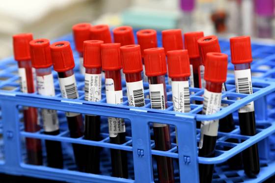 The study’s purpose is to look at the levels of immunity in the population, figure out when the pandemic will end, and finding a safe way for the world to open up, said Dr. Catherine Hankins, a McGill University public health professor. (Taimy Alvarez / The Associated Press files)