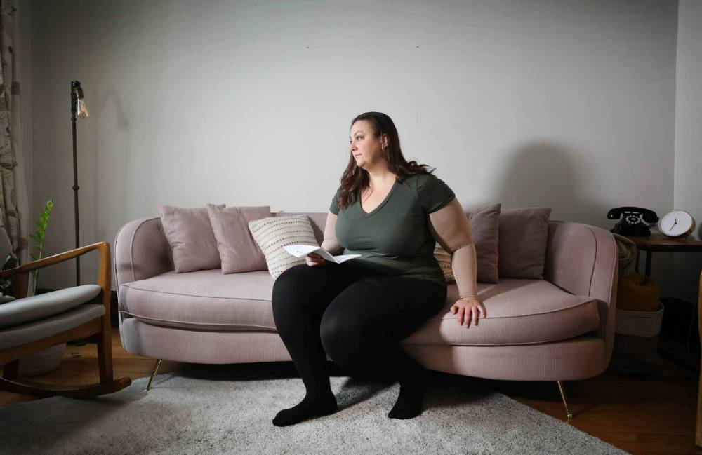 RUTH BONNEVILLE / WINNIPEG FREE PRESS
Emma Cloney has a condition known as who has advanced lipedema, characterized by enlargement of an area of the body, especially the limbs.