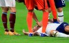 FILE - Tottenham's Toby Alderweireld is checked by fellow players after injuring his head during the English Premier League soccer match between Burnley and Tottenham Hotspur at Turf Moor stadium, Burnley, England, in this Monday, Oct. 26, 2020, file photo. U.S. Soccer, Major League Soccer and the National Women's Soccer League are joining a trial program that will allow teams two additional substitutes for suspected concussions in each match. The English Premier League has allowed use of concussion substitutes since early February. (Lindsey Parnaby/Pool via AP, File)