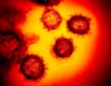 FILE - This undated electron microscope image made available by the U.S. National Institutes of Health in February 2020 shows the Novel Coronavirus SARS-CoV-2, the virus causes COVID-19. A new type of coronavirus test offers a cheaper, quicker way to screen for infections, moving the U.S. toward the kind of mass screening that experts say is essential to returning millions of Americans to school and work. But the first so-called antigen test _ announced Saturday, may 9, 2020 by the Food and Drug Administration _ is not quite the kind sought by top government health officials. It is less accurate than the current gold standard for testing and can only be run on specialized equipment. (NIAID-RML via AP)