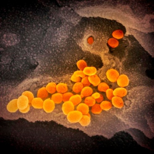 This undated electron microscope image made available by the U.S. National Institutes of Health in February 2020 shows the Novel Coronavirus SARS-CoV-2, orange, emerging from the surface of cells, gray, cultured in the lab. Also known as 2019-nCoV, the virus causes COVID-19. The sample was isolated from a patient in the U.S. THE CANADIAN PRESS/NIAID-RML via AP