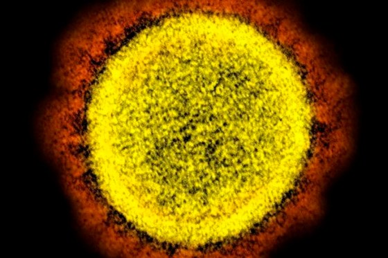 This 2020 electron microscope image made available by the National Institute of Allergy and Infectious Diseases shows a Novel Coronavirus SARS-CoV-2 particle isolated from a patient, in a laboratory in Fort Detrick, Md. THE CANADIAN PRESS/AP-NIAID/NIH via AP