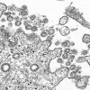 This 2020 electron microscope made available by the U.S. Centers for Disease Control and Prevention image shows the spherical coronavirus particles from the first U.S. case of COVID-19. Canada's health research granting agency has postponed its usual funding competition due to COVID-19, sparking concern that the lack of funds could disrupt regular health research. THE CANADIAN PRESS/C.S. Goldsmith, A. Tamin/ CDC via AP