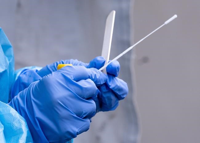A nurse gets a swab ready at a temporary COVID-19 test clinic in Montreal, on Friday, May 15, 2020. Quebec is reporting three new deaths attributed to COVID-19 in the last 24 hours, for a total of 5,577. THE CANADIAN PRESS/Paul Chiasson