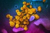 This undated electron microscope image made available by the U.S. National Institutes of Health in February 2020 shows the Novel Coronavirus SARS-CoV-2, yellow, emerging from the surface of cells, blue/pink, cultured in the lab. Also known as 2019-nCoV, the virus causes COVID-19. Experts say necessary measures to fight the COVID-19 pandemic could be setting Canada back in the battle against superbugs.THE CANADIAN PRESS/AP, NIAID-RML