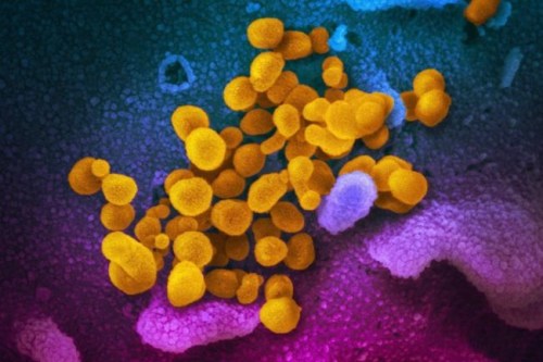 This undated electron microscope image made available by the U.S. National Institutes of Health in February 2020 shows the Novel Coronavirus SARS-CoV-2, yellow, emerging from the surface of cells, blue/pink, cultured in the lab. Also known as 2019-nCoV, the virus causes COVID-19. Experts say necessary measures to fight the COVID-19 pandemic could be setting Canada back in the battle against superbugs.THE CANADIAN PRESS/AP, NIAID-RML