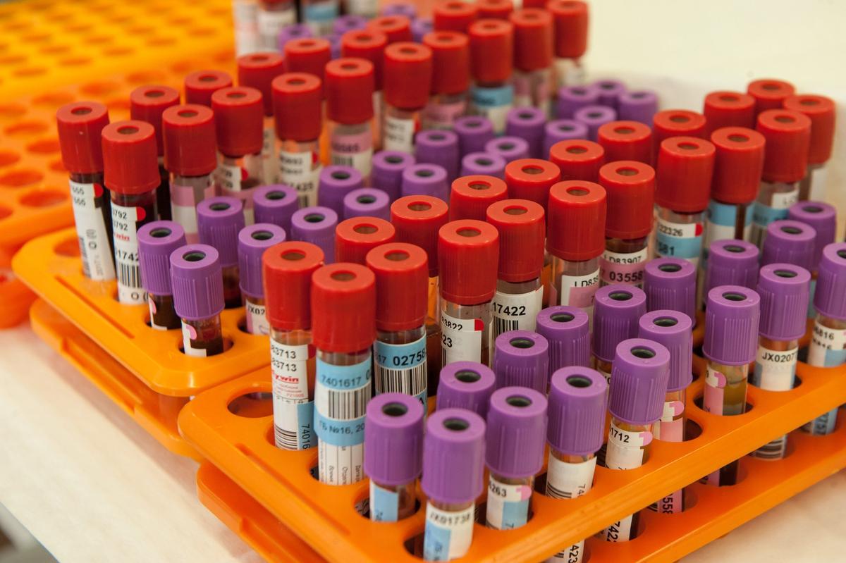 Why are Canadian police using expired blood collection equipment in DUI