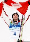 The Canadian Press
Alex Bilodeau