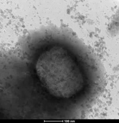 An electronic microscope image shows the monkeypox virus seen by a team from the Arbovirus Laboratory and the Genomics and Bioinformatics Units of the Carlos III Health Institute (ISCIII) in Madrid, Thursday May 26, 2022. The Public Health Agency of Canada is warning travellers to be extra careful abroad because of the potential threat of catching monkeypox. THE CANADIAN PRESS/Unidad de Microscopi­a Electronica del ISCIII, via AP